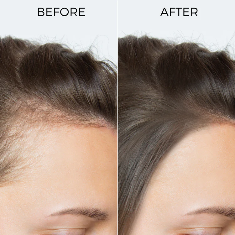 100% Rosemary Essential Oil for Hair Growth - Image 6