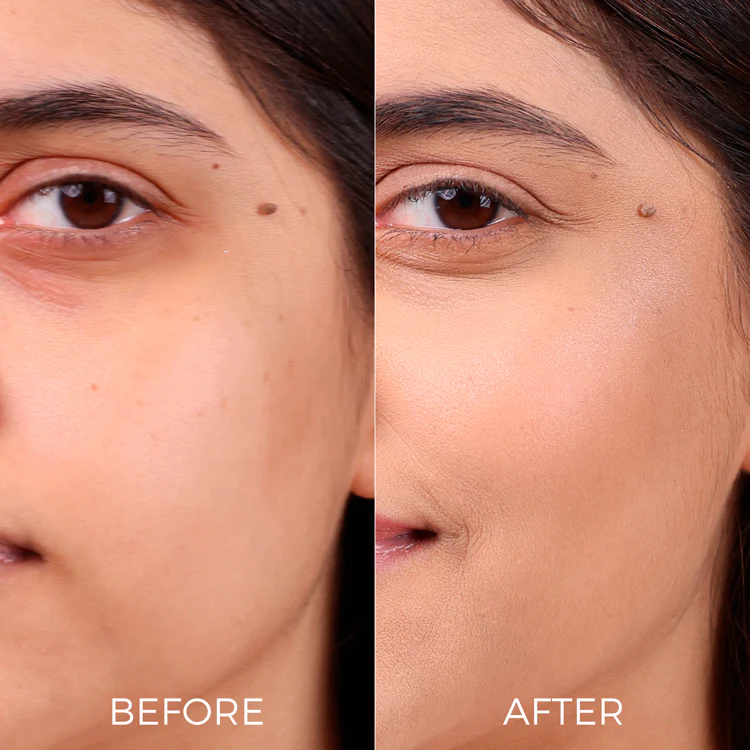 2% Hyaluronic Acid Face Serum For youthful Skin - Image 4
