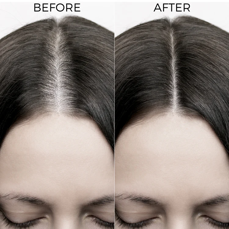 Onion & Bakuchiol Oil Shots For Hair Fall Reduction - Image 5