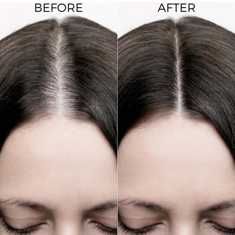 Rosemary Hair Oil for Hair Growth - Image 6
