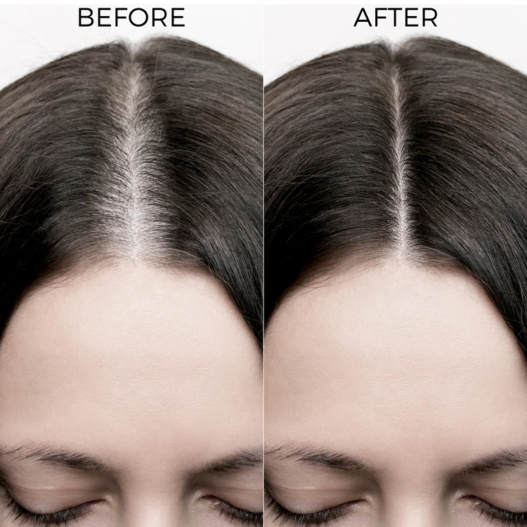 Rosemary Oil Shots For Visible Hair Growth - Image 4