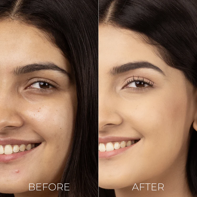 Salicylic Acid Liquid Moisturiser for oily, acne prone skin - Image 6