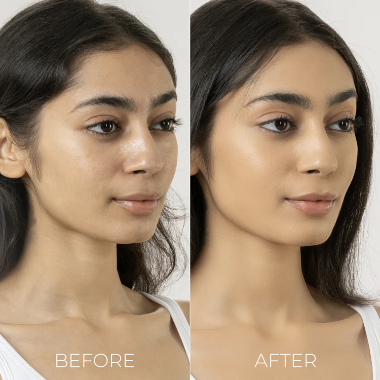 2% Salicylic and 3% Lactic Acid Face Wash for acne prone skin - Image 6