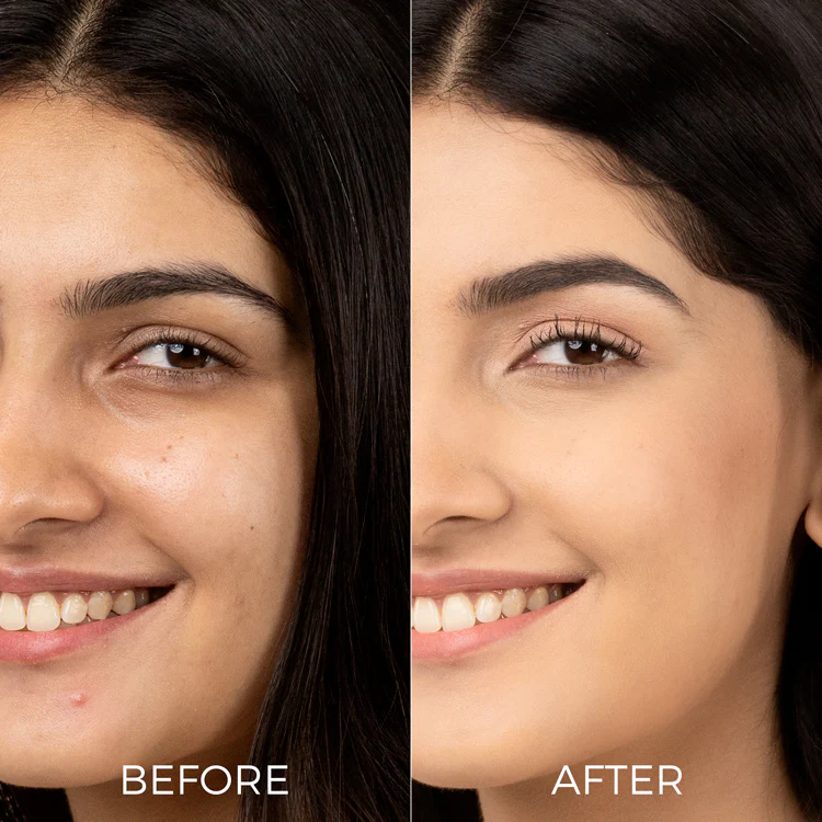 10% Vitamin C Face Serum for Bright, Glowing Skin - Image 4